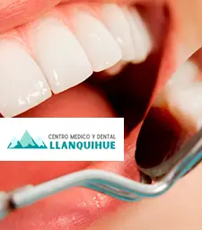 Caja 18 | Centro Dental Llanquihue